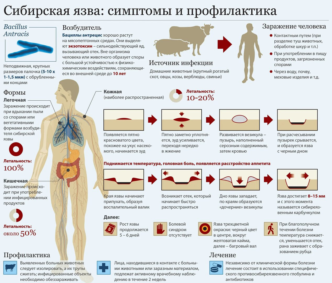 О мерах профилактики сибирской язвы